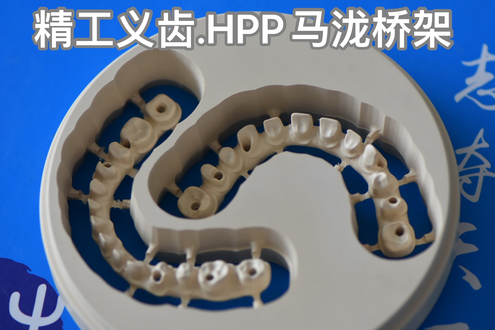 精工义齿-HPP 马泷桥架